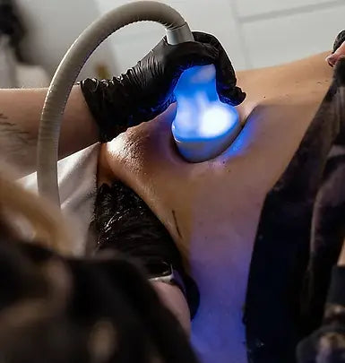 Cryoskin® Revolution Dynamic (wand only)