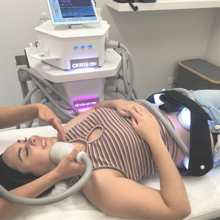 Cryoskin® Revolution Full Unit (wand + static pads)