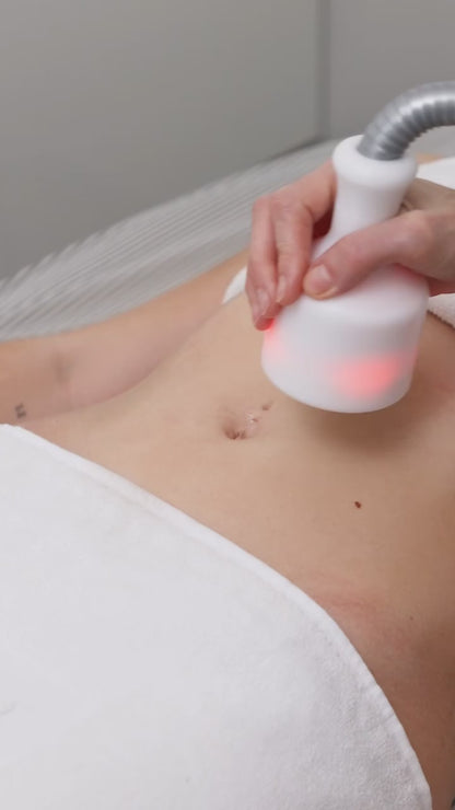 Cryoskin® Revolution Full Unit (wand + static pads)